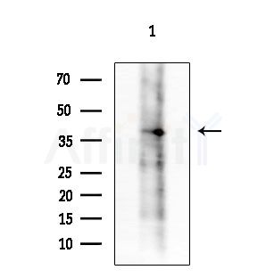 NMBR Antibody - Western blot analysis of extracts from COLO205 cells, using NMBR Antibody at 1/1000 dilution.