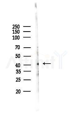 NMBR Antibody - Western blot analysis of lysates from COLO205 cells, using NMBR Antibody at 1/1000 dilution.
