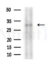 OR13C3 Antibody - Western blot analysis of lysates from A375 cells(heat-shock,45min treatment), using OR13C3 Antibody at 1/1000 dilution.