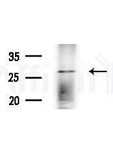 OR2T11 Antibody - Western blot analysis of lysates from Rat lung, using OR2T11 Antibody at 1/1000 dilution.