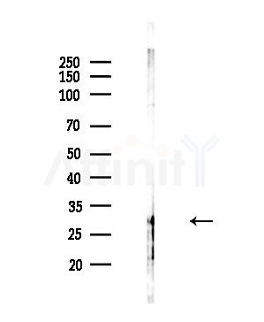 OR4F4/4F5/4F17 Antibody - Western blot analysis of lysates from HepG2 cells(LPS,4h treatment), using OR4F4/4F5/4F17 Antibody at 1/1000 dilution.