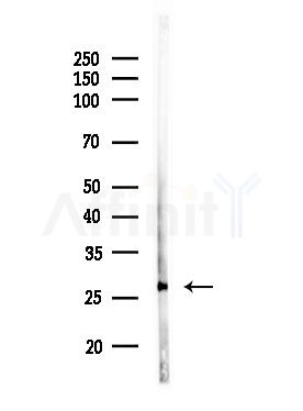 OR51I2 Antibody - Western blot analysis of lysates from Rat liver, using OR51I2 Antibody at 1/1000 dilution.