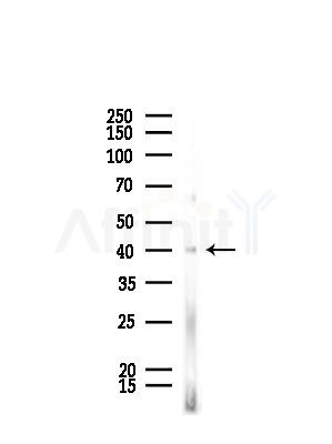 OR51T1 Antibody - Western blot analysis of lysates from Rat lung, using OR51T1 Antibody at 1/1000 dilution.