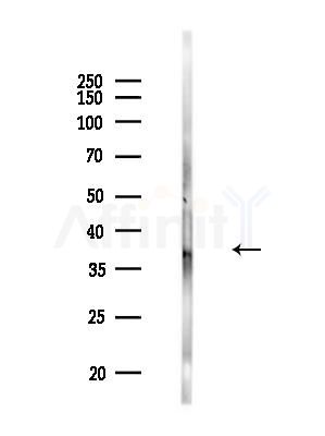 OR10D4 Antibody - Western blot analysis of lysates from Rat lung, using OR10D4 Antibody at 1/1000 dilution.