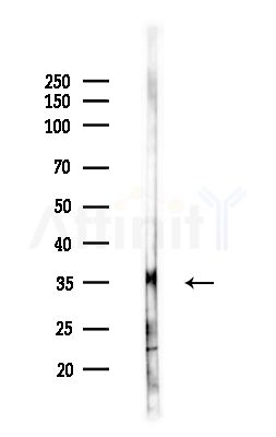 OR1B1 Antibody - Western blot analysis of lysates from PC12 cells(LPS,4h treatment), using OR1B1 Antibody at 1/1000 dilution.
