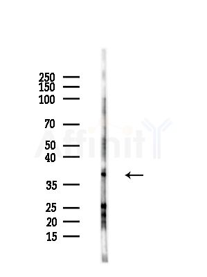 OR2M2 Antibody - Western blot analysis of lysates from HepG2 cells(LPS,4h treatment), using OR2M2 Antibody at 1/1000 dilution.