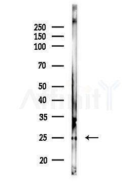 OR2T1 Antibody - Western blot analysis of lysates from Rat liver, using OR2T1 Antibody at 1/1000 dilution.