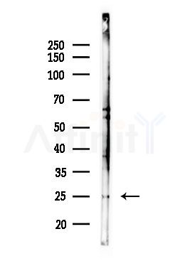 OR2T1 Antibody - Western blot analysis of lysates from Hela cells(heat-shock,45min treatment), using OR2T1 Antibody at 1/1000 dilution.