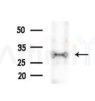 OR4A4/47 Antibody - Western blot analysis of lysates from 293 cells, using OR4A4/47 Antibody at 1/1000 dilution.