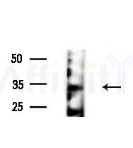 OR4C13 Antibody - Western blot analysis of lysates from various samples, using OR4C13 Antibody at 1/1000 dilution.
