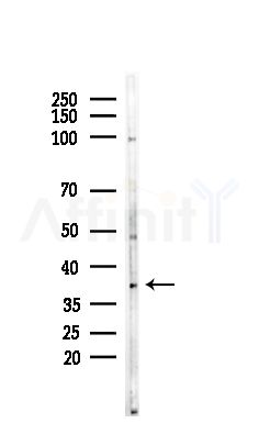 OR4D6 Antibody - Western blot analysis of lysates from EC304 cells, using OR4D6 Antibody at 1/1000 dilution.