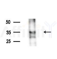 OR4P4 Antibody - Western blot analysis of lysates from various samples, using OR4P4 Antibody at 1/1000 dilution.