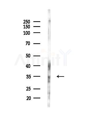 OR4P4 Antibody - Western blot analysis of lysates from B16F10-LUC cells(LPS,4h treatment), using OR4P4 Antibody at 1/1000 dilution.