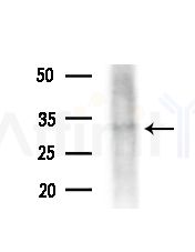 OR5W2 Antibody - Western blot analysis of lysates from A375 cells(heat-shock,45min treatment), using OR5W2 Antibody at 1/1000 dilution.