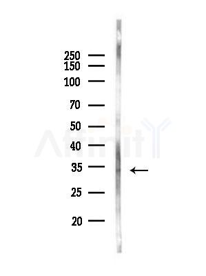 OR5W2 Antibody - Western blot analysis of lysates from A375 cells(heat-shock,45min treatment), using OR5W2 Antibody at 1/1000 dilution.
