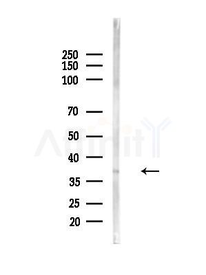 OR6K2 Antibody - Western blot analysis of lysates from Hela cells(LPS,4h treatment), using OR6K2 Antibody at 1/1000 dilution.
