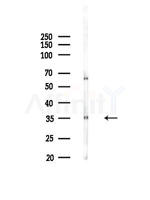 OR6S1 Antibody - Western blot analysis of lysates from COLO205 cells, using OR6S1 Antibody at 1/1000 dilution.