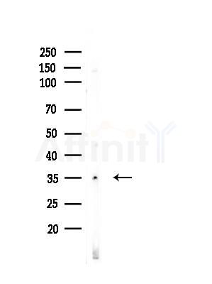 OR8G5 Antibody - Western blot analysis of lysates from EC304 cells, using OR8G5 Antibody at 1/1000 dilution.