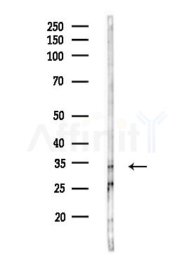 OR9Q1 Antibody - Western blot analysis of lysates from MDA-MB-231 cells(heat-shock,45min treatment), using OR9Q1 Antibody at 1/1000 dilution.