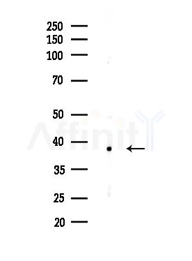 OR9Q2 Antibody - Western blot analysis of lysates from MDA-MB-231 cells(heat-shock,45min treatment), using OR9Q2 Antibody at 1/1000 dilution.