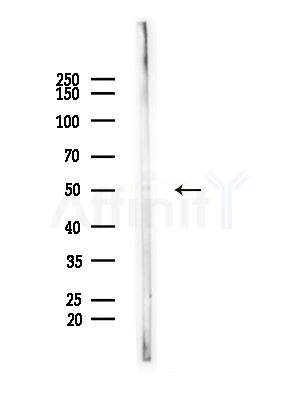 P2RY8 Antibody - Western blot analysis of lysates from A375 cells(heat-shock,45min treatment), using P2RY8 Antibody at 1/1000 dilution.
