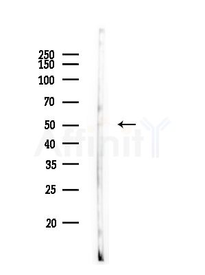 P2RY8 Antibody - Western blot analysis of lysates from PC12 cells, using P2RY8 Antibody at 1/1000 dilution.