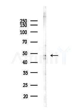 P2RY11 Antibody - Western blot analysis of lysates from EC304 cells(heat-shock,45min treatment), using P2RY11 Antibody at 1/1000 dilution.