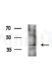 PEVR2 Antibody - Western blot analysis of extracts from A375 cells(heat-shock,45min treatment), using PEVR2 Antibody at 1/1000 dilution.