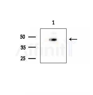 PKR1 Antibody - Western blot analysis of extracts from EC304 cells, using PKR1 Antibody at 1/1000 dilution.