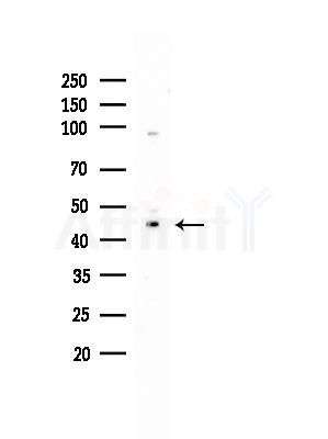 PKR1 Antibody - Western blot analysis of lysates from EC304 cells, using PKR1 Antibody at 1/1000 dilution.