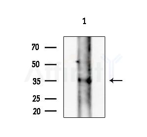 TAS2R10 Antibody - Western blot analysis of extracts from EC304 cells, using TAS2R10 Antibody at 1/1000 dilution.