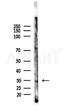 TAS2R10 Antibody - Western blot analysis of lysates from EC304 cells, using TAS2R10 Antibody at 1/1000 dilution.