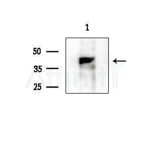 TAS2R14 Antibody - Western blot analysis of extracts from EC304 cells, using TAS2R14 Antibody at 1/1000 dilution.