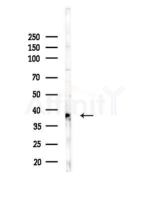 TAS2R14 Antibody - Western blot analysis of lysates from EC304 cells, using TAS2R14 Antibody at 1/1000 dilution.