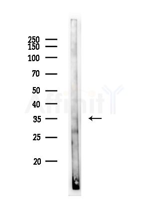 TAS2R48 Antibody - Western blot analysis of lysates from PC12 cells, using TAS2R48 Antibody at 1/1000 dilution.