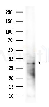 TAS2R49 Antibody - Western blot analysis of lysates from PC12 cells(LPS,4h treatment), using TAS2R49 Antibody at 1/1000 dilution.