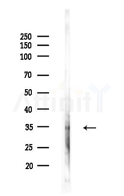 TAS2R49 Antibody - Western blot analysis of lysates from PC12 cells(LPS,4h treatment), using TAS2R49 Antibody at 1/1000 dilution.