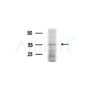 TAS2R5 Antibody - Western blot analysis of lysates from A375 cells(heat-shock,45min treatment), using TAS2R5 Antibody at 1/1000 dilution.