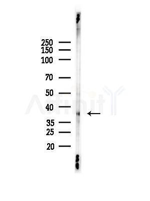 OR10G7 Antibody - Western blot analysis of lysates from EC304 cells(heat-shock,45min treatment), using OR10G7 Antibody at 1/1000 dilution.