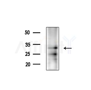 OR51B5 Antibody - Western blot analysis of lysates from A375 cells(heat-shock,45min treatment), using OR51B5 Antibody at 1/1000 dilution.