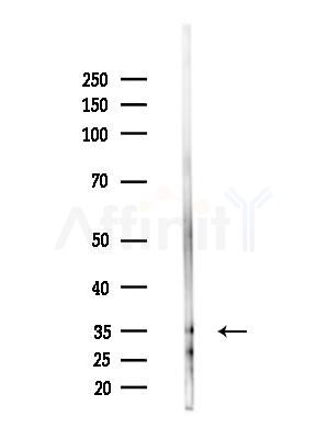 OR51B5 Antibody - Western blot analysis of lysates from A375 cells(heat-shock,45min treatment), using OR51B5 Antibody at 1/1000 dilution.