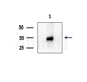 OR52E5 Antibody - Western blot analysis of extracts from EC304 cells, using OR52E5 Antibody at 1/1000 dilution.