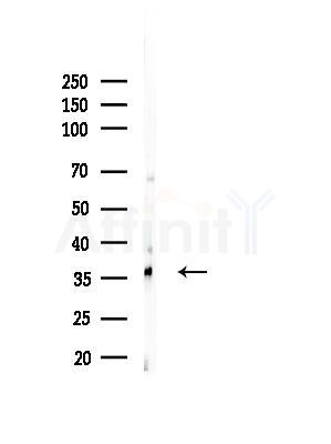 OR52E5 Antibody - Western blot analysis of lysates from EC304 cells, using OR52E5 Antibody at 1/1000 dilution.