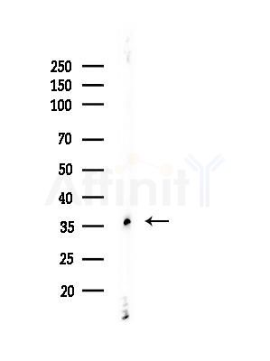 MAGEA5 Antibody - Western blot analysis of lysates from Rat brain, using MAGEA5 Antibody at 1/1000 dilution.