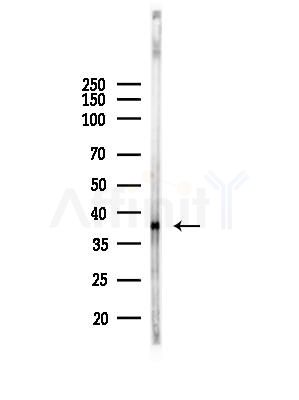 OR51B2 Antibody - Western blot analysis of lysates from EC304 cells(heat-shock,45min treatment), using OR51B2 Antibody at 1/1000 dilution.