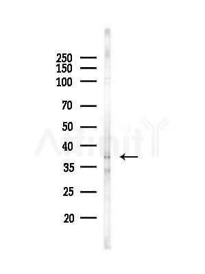 OR6J1 Antibody - Western blot analysis of lysates from EC304 cells(heat-shock,45min treatment), using OR6J1 Antibody at 1/1000 dilution.
