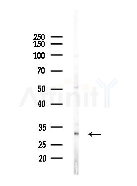 OR8K3 Antibody - Western blot analysis of lysates from Mouse lung, using OR8K3 Antibody at 1/1000 dilution.
