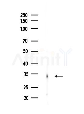 TAS2R45 Antibody - Western blot analysis of lysates from MDA-MB-231 cells(heat-shock,45min treatment), using TAS2R45 Antibody at 1/1000 dilution.