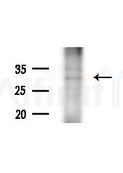 US28 Antibody - Western blot analysis of extracts from MCF7 cells(heat-shock,45min treatment), using US28 Antibody at 1/1000 dilution.