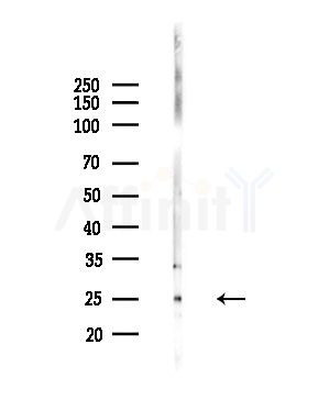 Bak Antibody - Western blot analysis of lysates from Hela cells(starvation,24h treatment), using Bak Antibody at 1/1000 dilution.